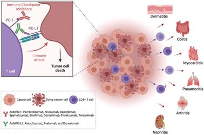 Bridging the Gap: Connecting the Mechanisms of Immune-Related Adverse Events and Autoimmunity Through PD-1